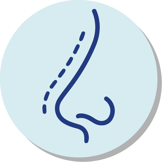 Rinoplastia